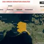 USA Organ Donation Analysis
